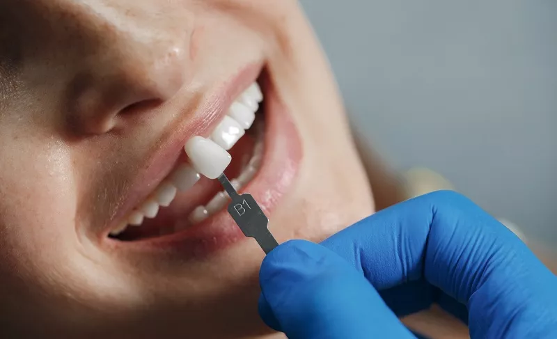 Enhance Your Smile with Veneers
