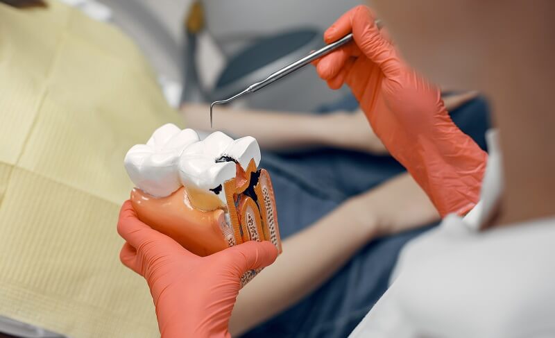 model-tooth-dentist-doctor-shows-patient-tooth-reception-dentist-s-office (1) Dental Fillings: Importance and Cost