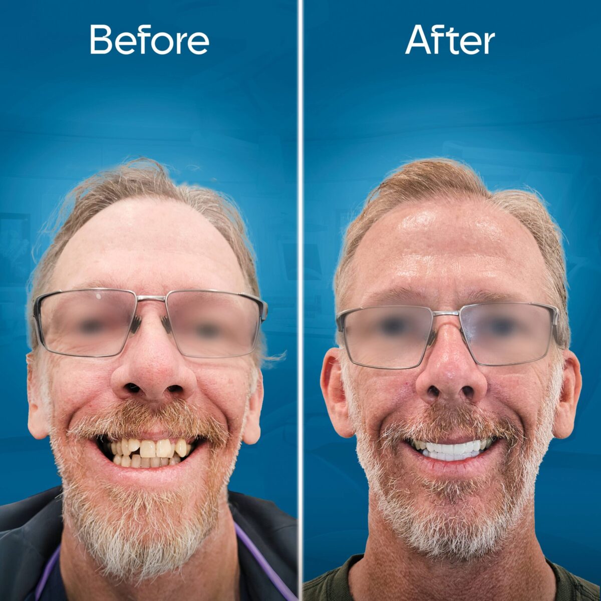 before-and-after-2 copy 2-min