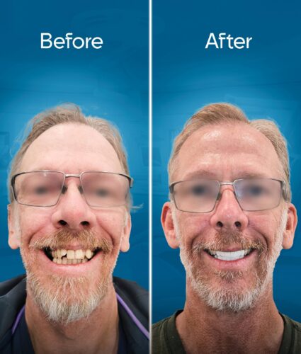 before-and-after-2 copy 2-min