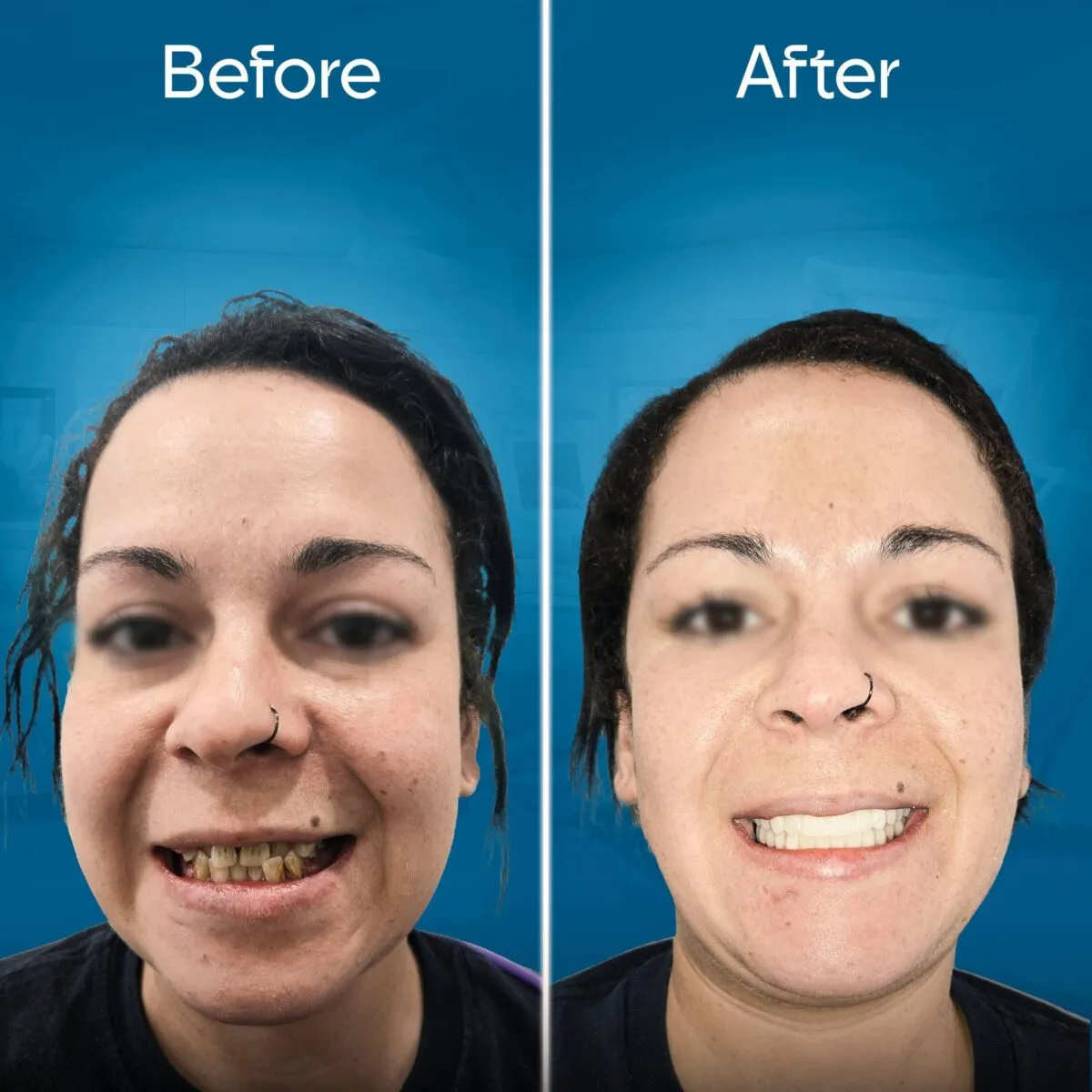 before-and-after-2 copy 3-min