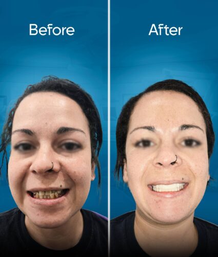 before-and-after-2 copy 3-min