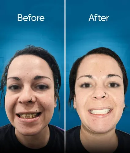 before-and-after-2 copy 3-min