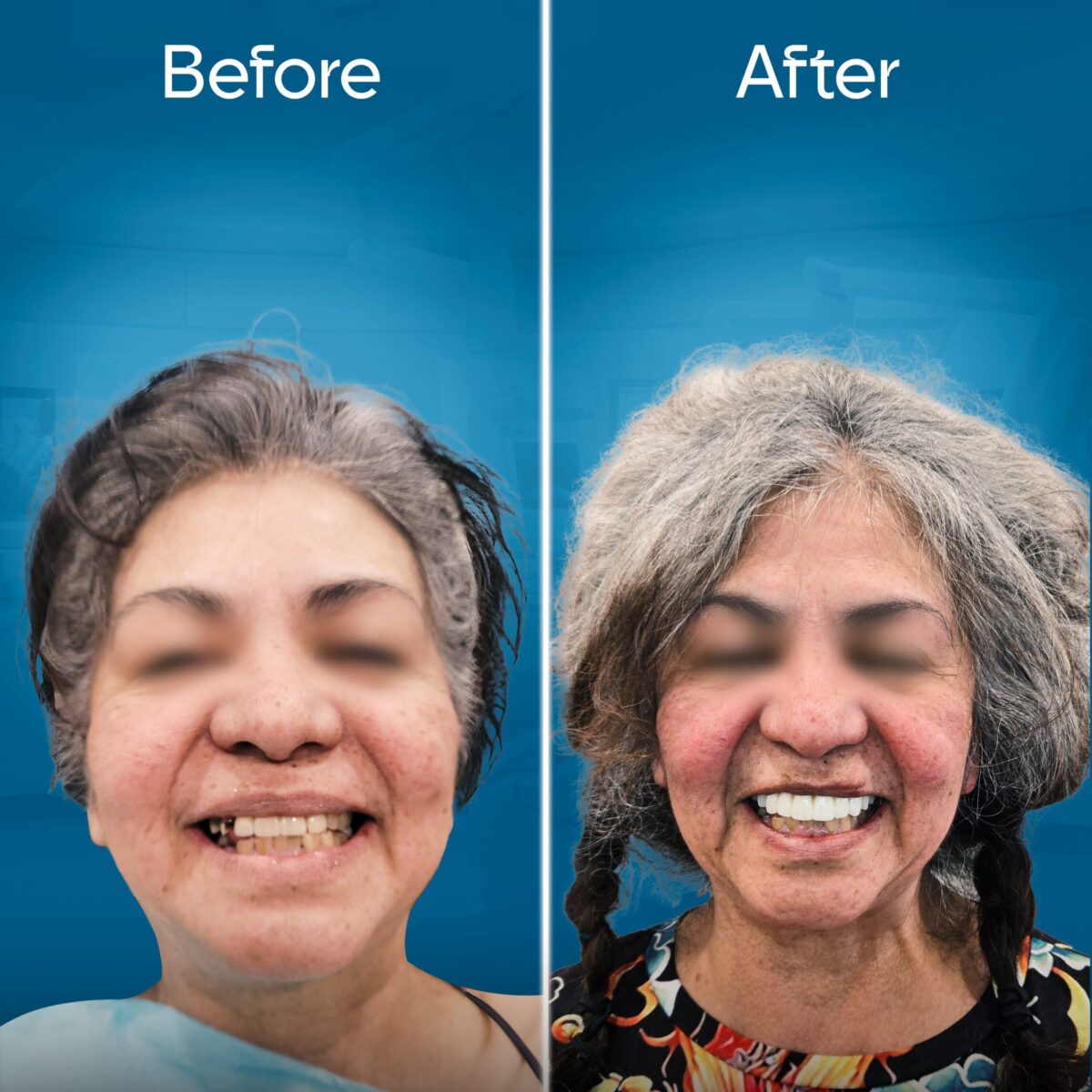 before-and-after-2 copy 4-min