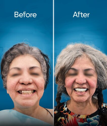 before-and-after-2 copy 4-min