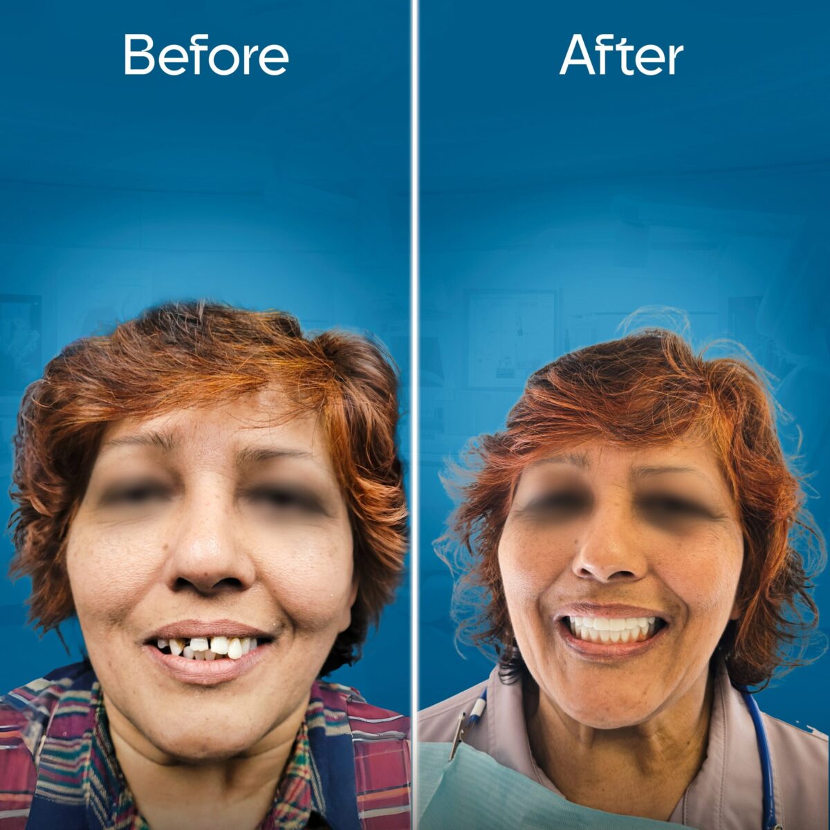 before-and-after-2 copy 5-min