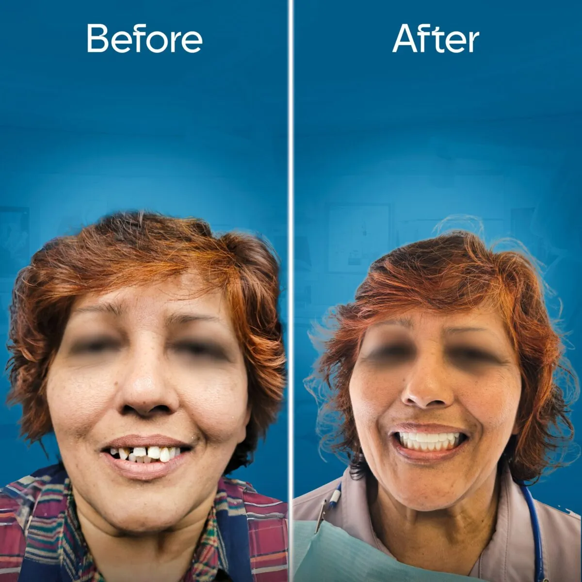 before-and-after-2 copy 5-min