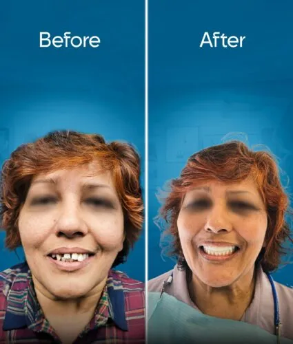 before-and-after-2 copy 5-min