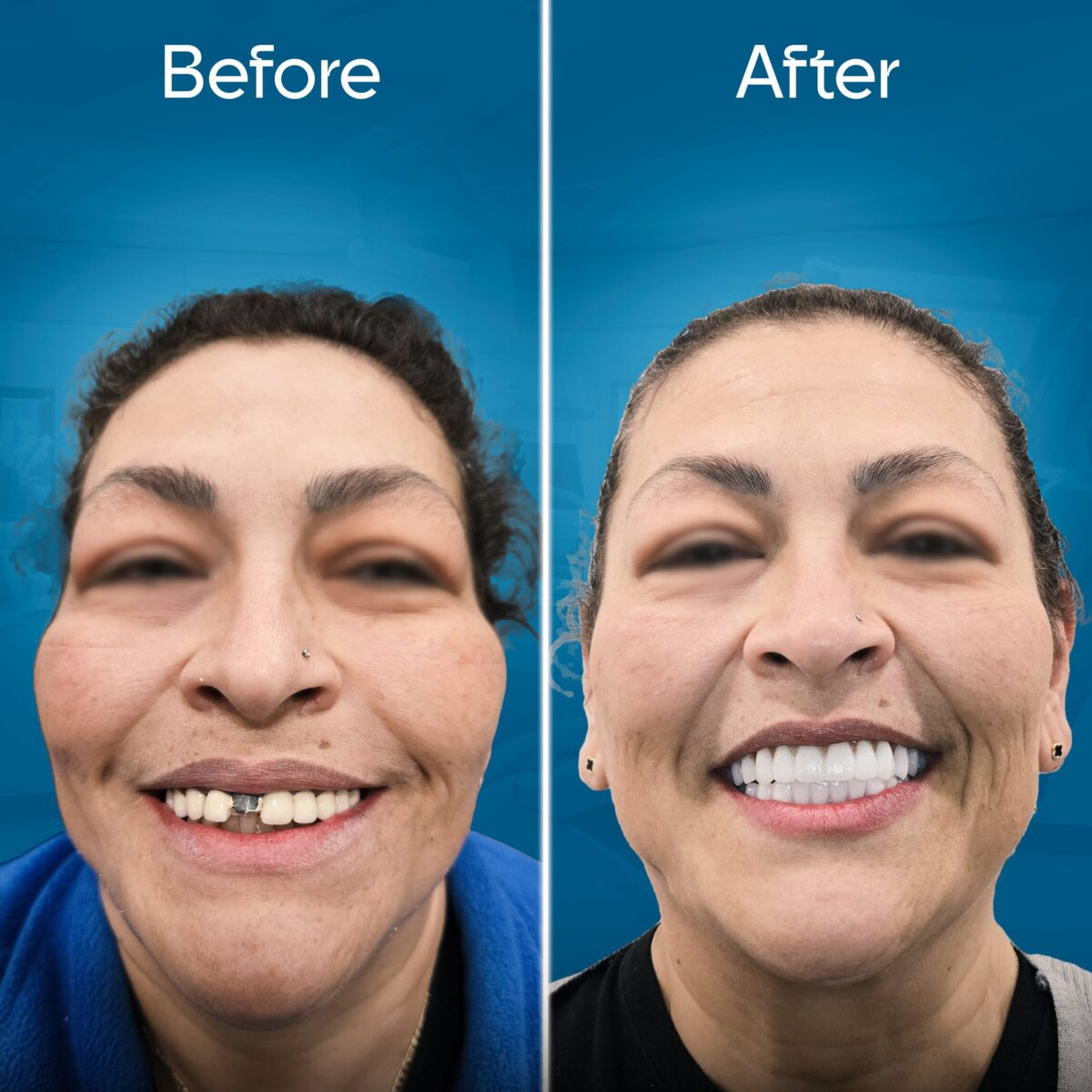 before-and-after-2 copy 6-min