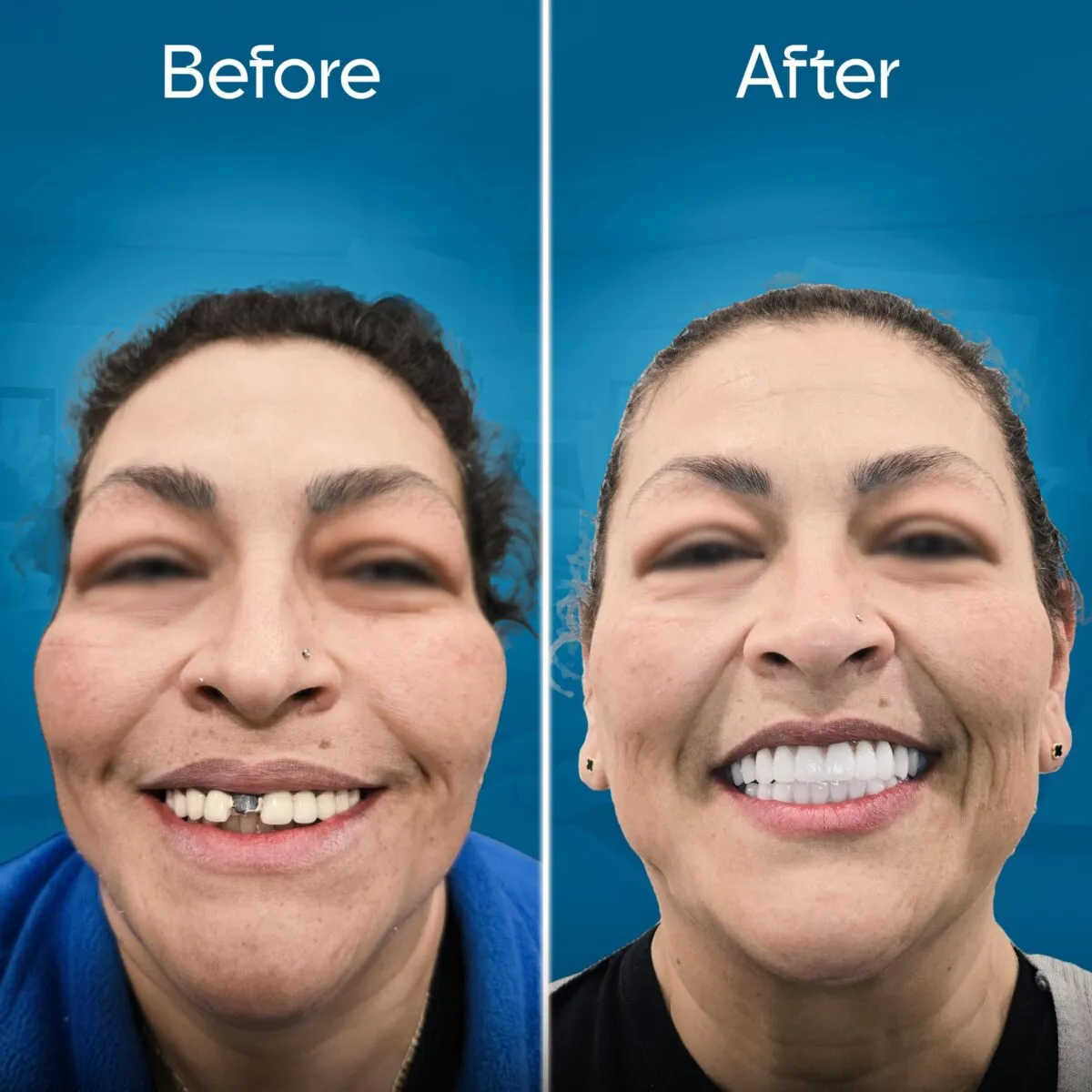 before-and-after-2 copy 6-min