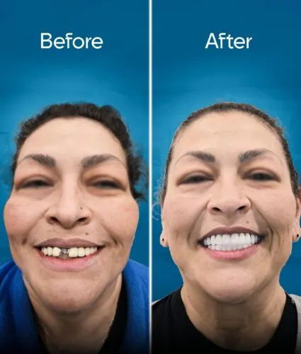 before-and-after-2 copy 6-min