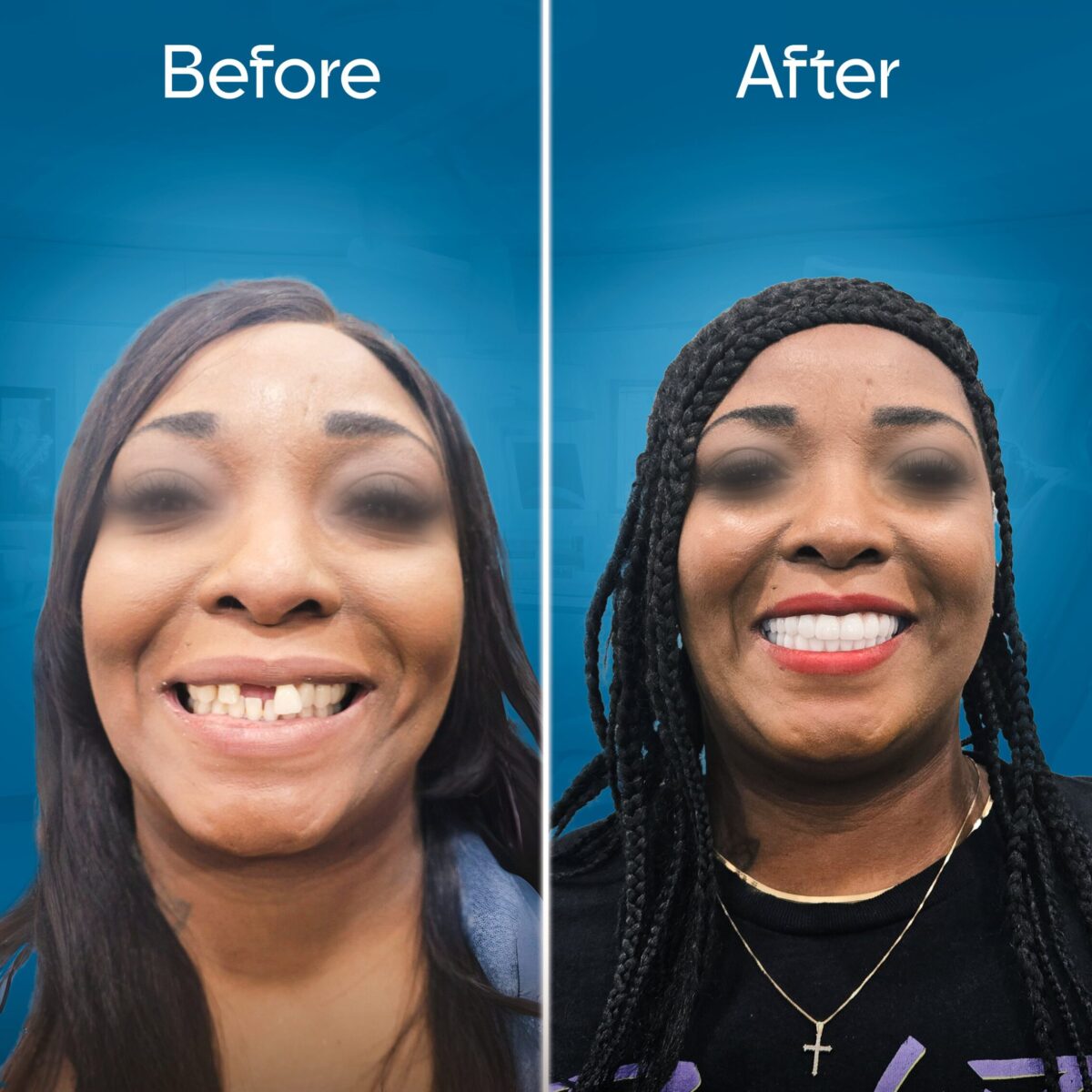 before-and-after-2 copy-min