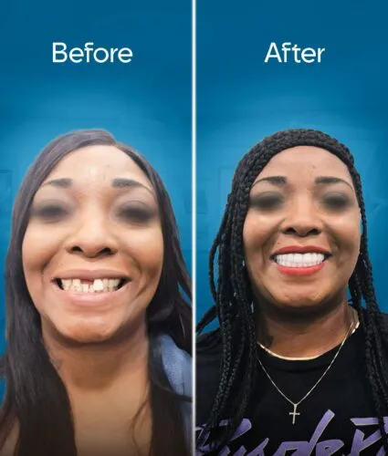 before-and-after-2 copy-min