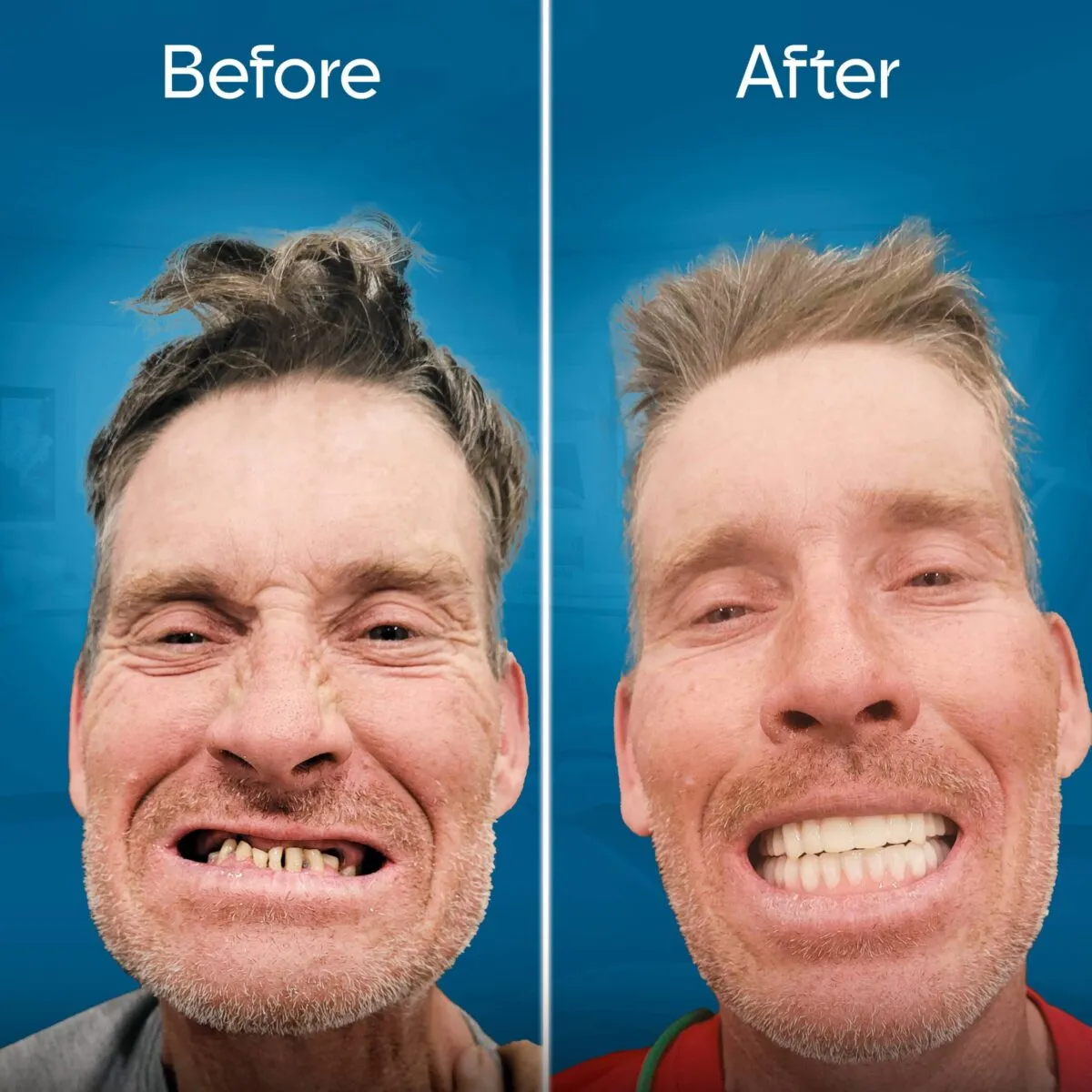 before and after 2-min