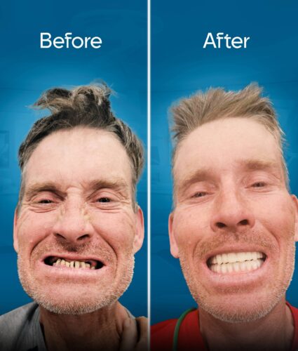 before and after 2-min