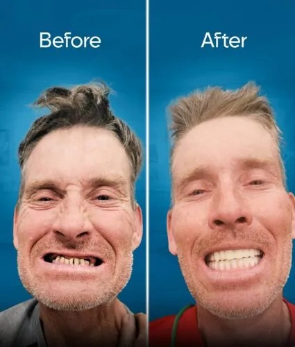 before and after 2-min