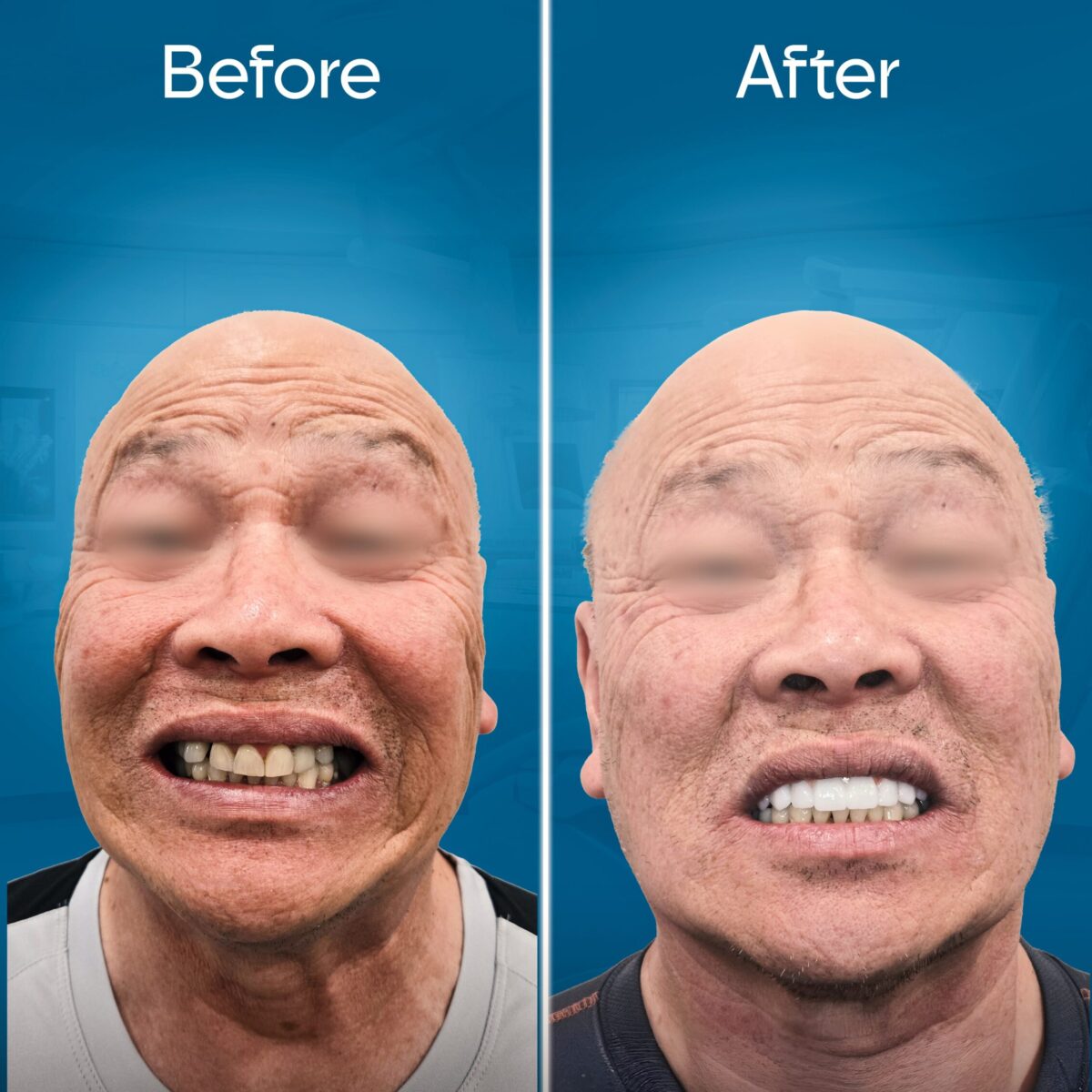 before-and-after-2-min