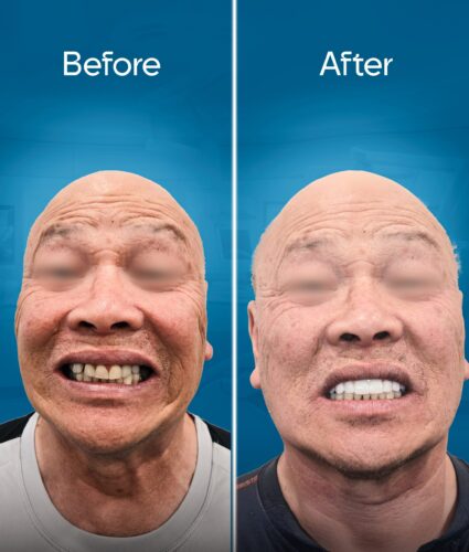 before-and-after-2-min