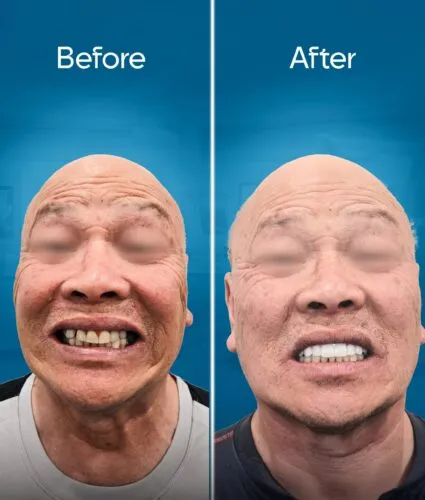 before-and-after-2-min