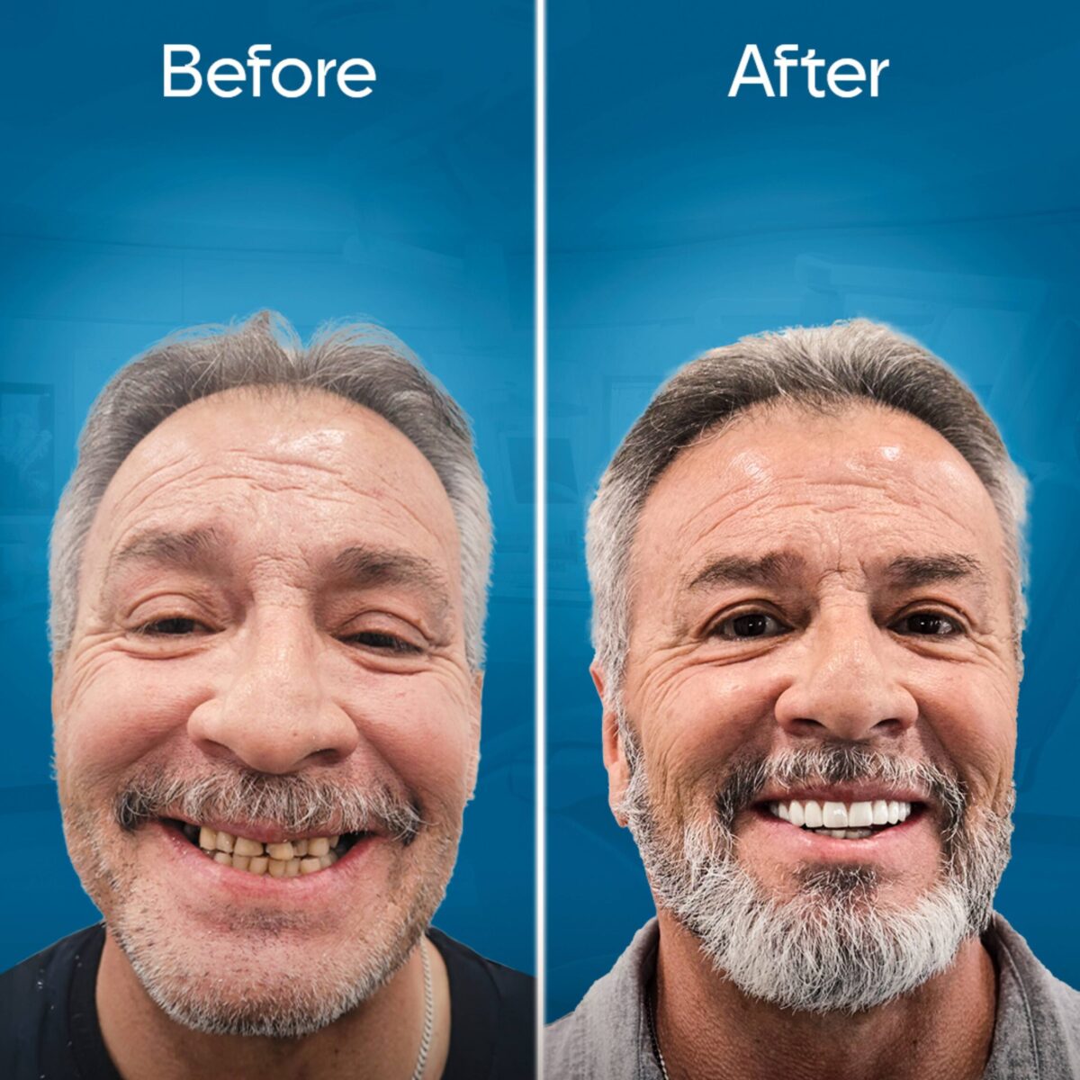 before-and-after-3 copy 2-min