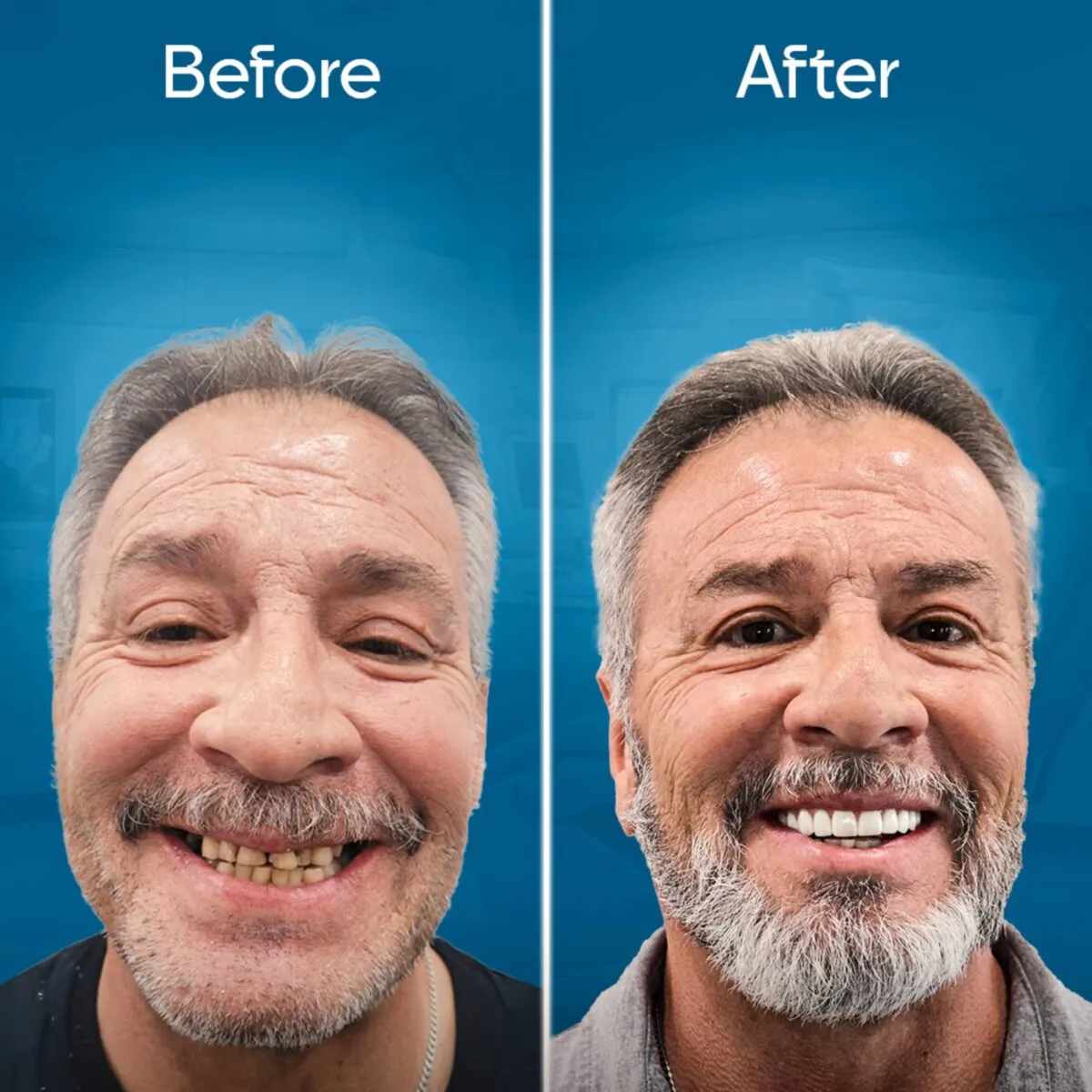 before-and-after-3 copy 2-min