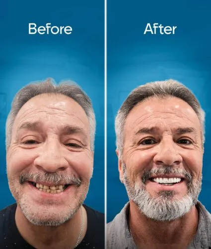 before-and-after-3 copy 2-min