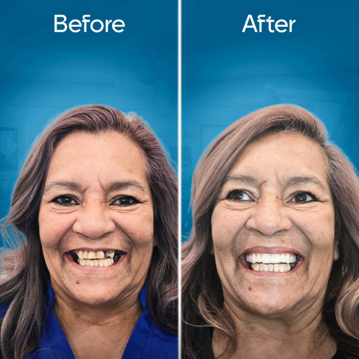 before-and-after-3 copy 3-min