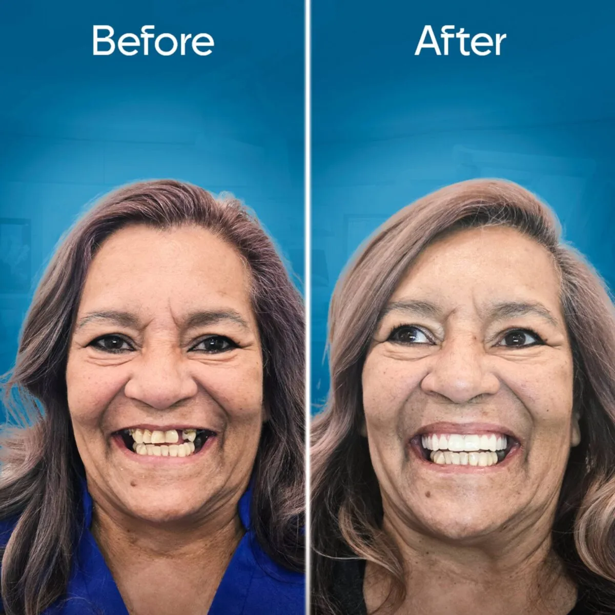 before-and-after-3 copy 3-min