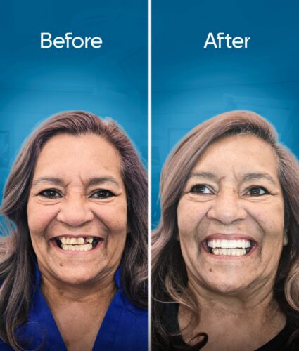 before-and-after-3 copy 3-min