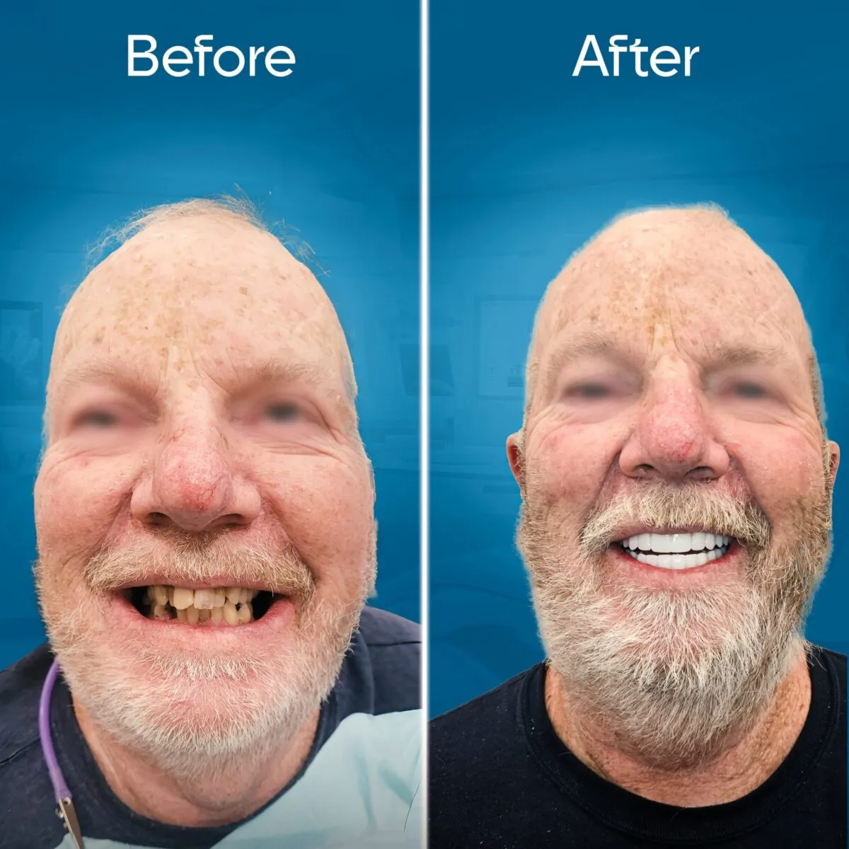 before-and-after-3 copy 4-min