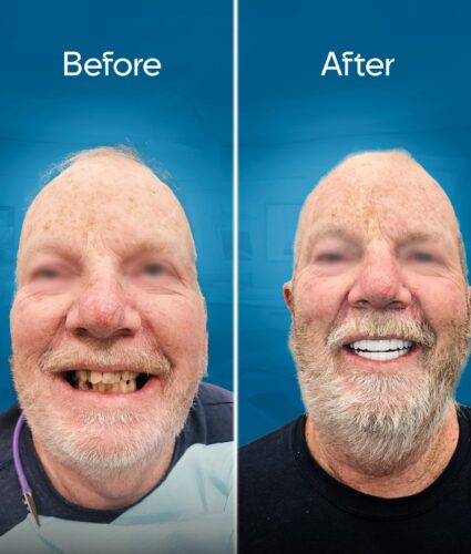 before-and-after-3 copy 4-min