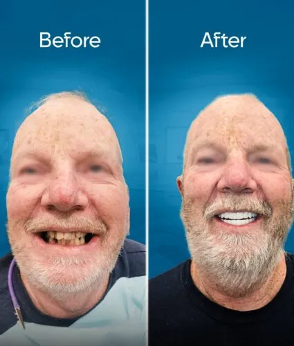 before-and-after-3 copy 4-min