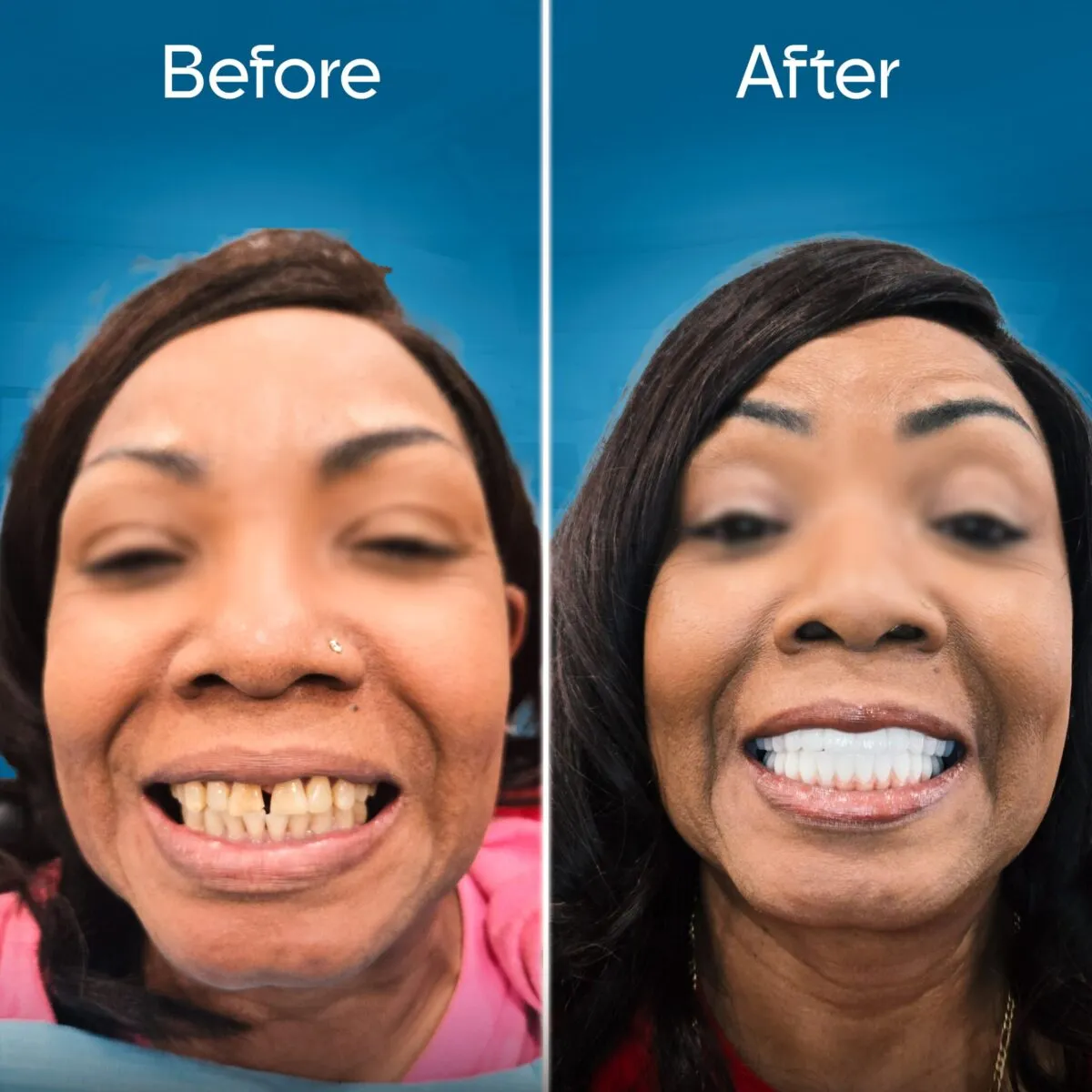 before-and-after-3 copy 5-min