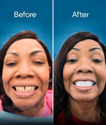 before-and-after-3 copy 5-min