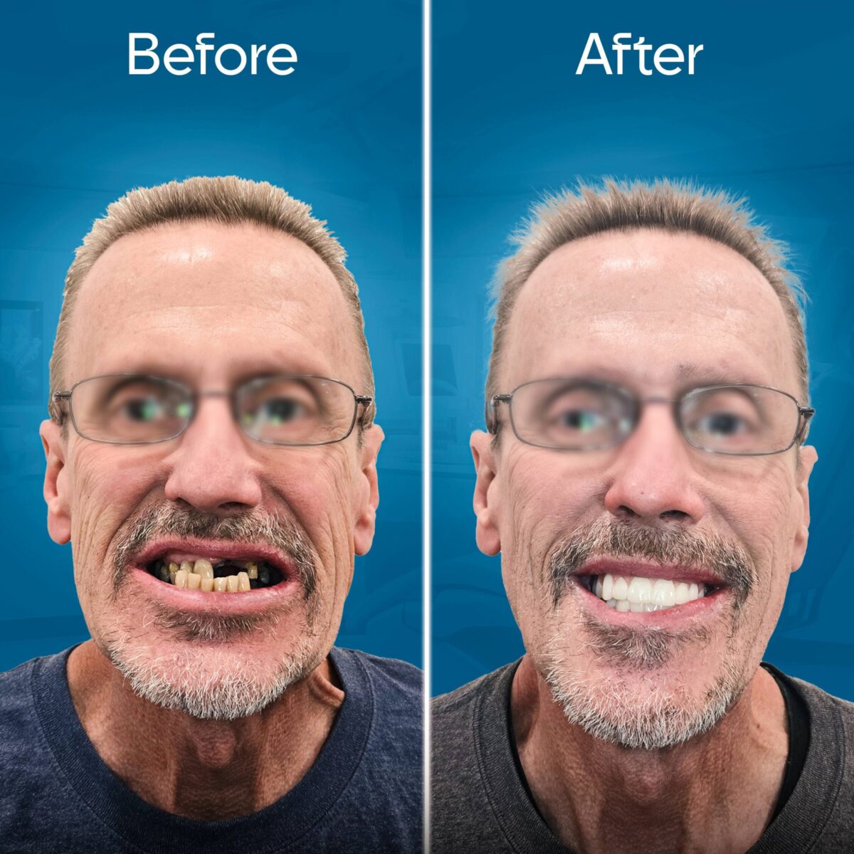 before-and-after-3 copy 6-min