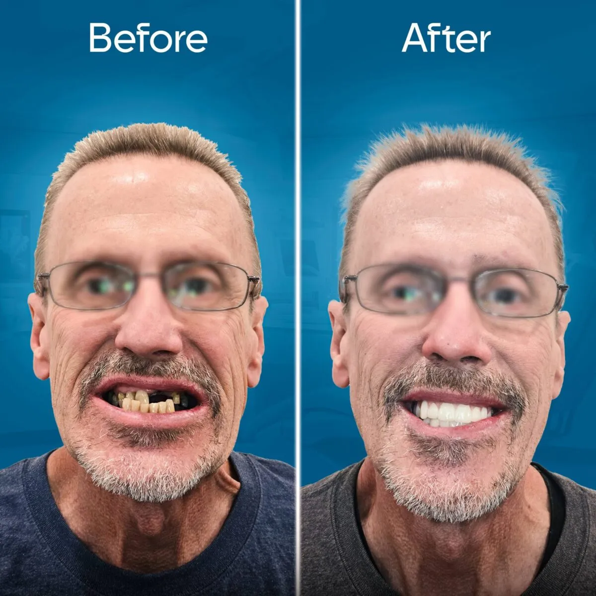 before-and-after-3 copy 6-min