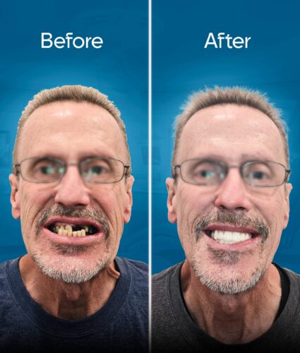 before-and-after-3 copy 6-min