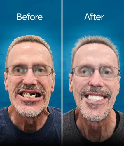 before-and-after-3 copy 6-min