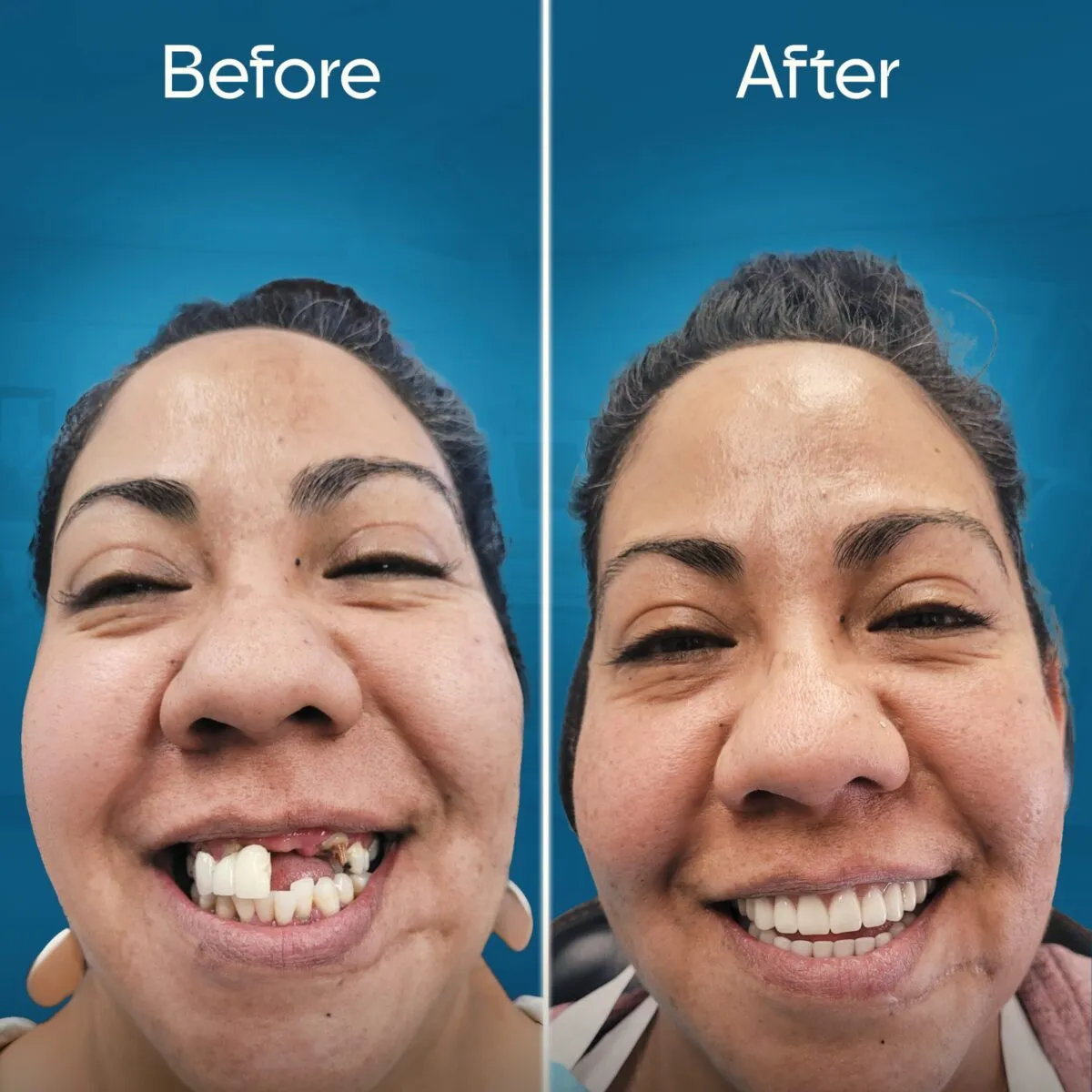 before-and-after-3 copy 7-min