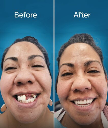 before-and-after-3 copy 7-min