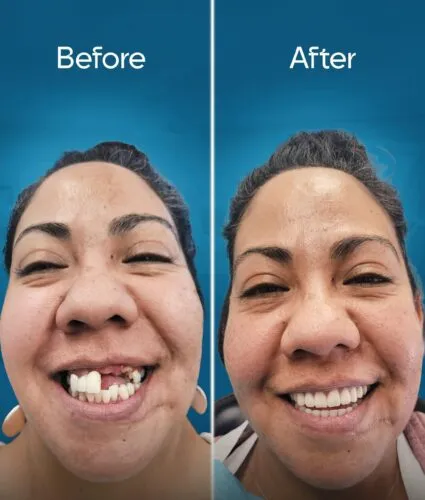 before-and-after-3 copy 7-min