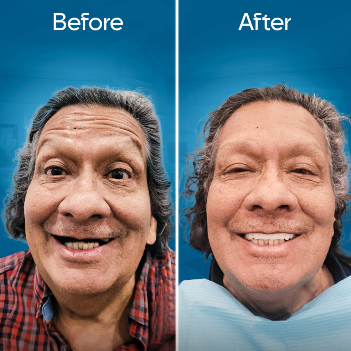 before-and-after-3 copy-min