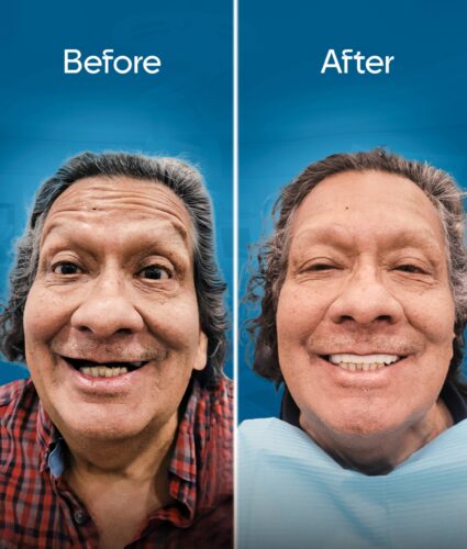 before-and-after-3 copy-min