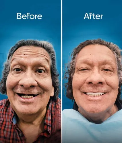 before-and-after-3 copy-min