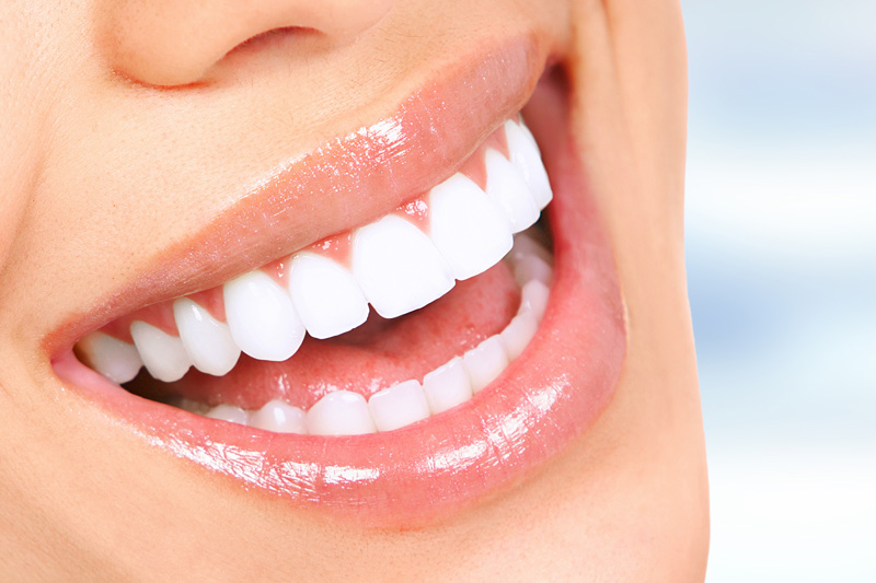 Cosmetic Dentistry in Lakewood