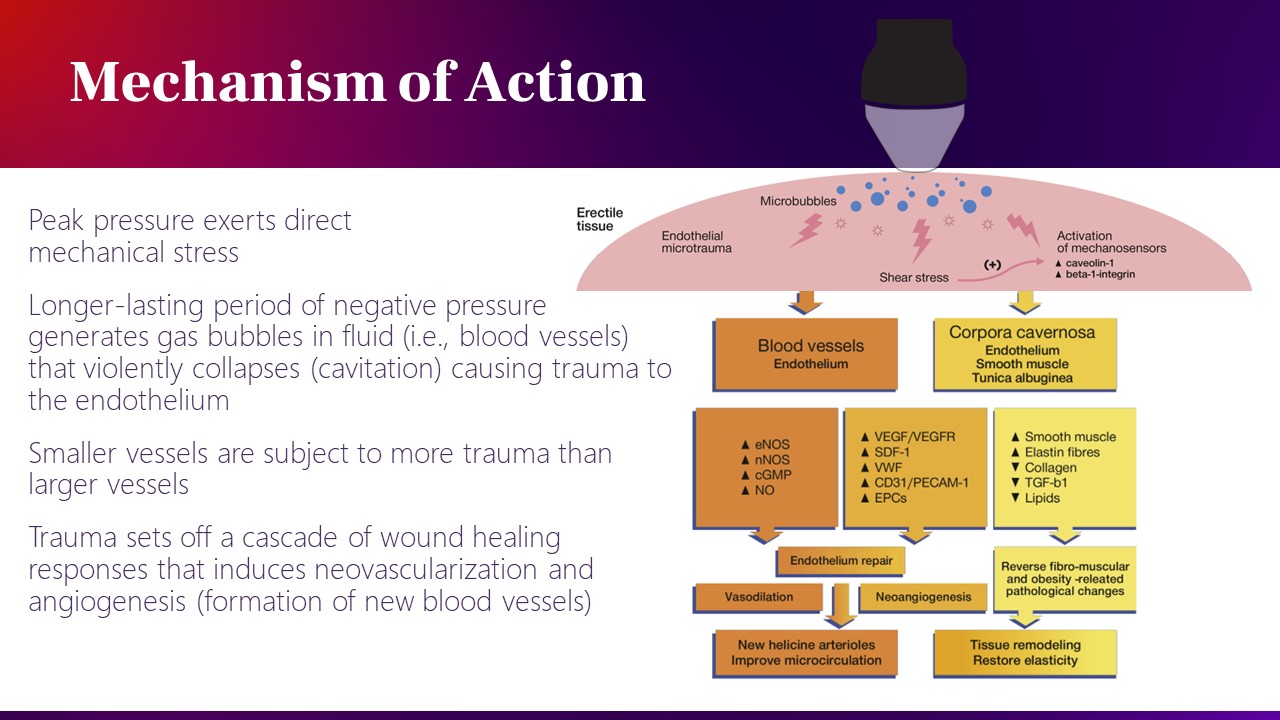 Mechanism of action for shockwave therapy